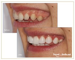 Slider image (7) Travel and Smile